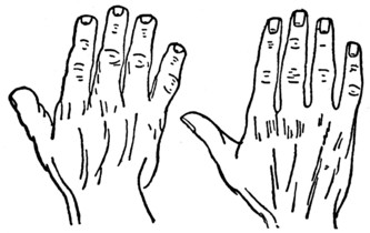 Plate I.&mdash;Part II. Fig. 1&mdash;THE ELEMENTARY HAND. Fig. 2&mdash;THE SQUARE OR USEFUL HAND. Fig. 3&mdash;THE SPATULATE HAND. Fig. 4&mdash;THE PHILOSOPHIC HAND.