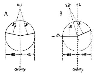    R, Direction of reaction of wing indicated.
  R R, Resultant direction of reaction of both wings.
    M, Horizontal (sideway) component of reaction.
    L, Vertical component of reaction (lift).
