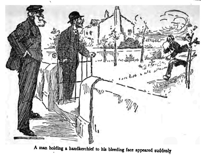 Holding a Handkerchief to his Bleeding Face 134
